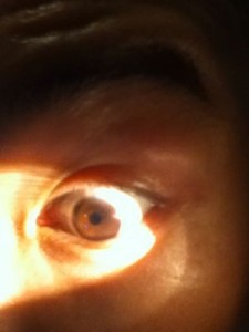 瞳孔検査　眼球